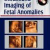 Ultrasound Imaging of Fetal Anomalies (PDF)