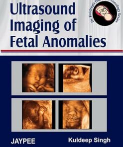 Ultrasound Imaging of Fetal Anomalies (PDF)