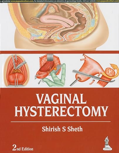 Vaginal Hysterectomy 2nd Edition (PDF)