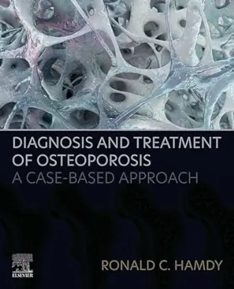 Diagnosis And Treatment Of Osteoporosis: A Case-Based Approach (PDF)