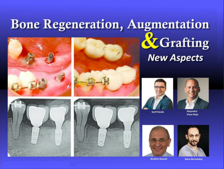 Bone Regeneration, Augmentation & Grafting, New Aspects