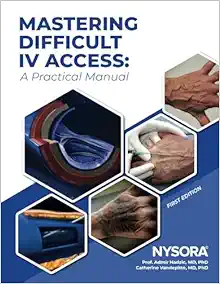 Mastering Difficult IV Access: A Practical Manual (PDF)