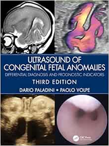 Ultrasound Of Congenital Fetal Anomalies: Differential Diagnosis And Prognostic Indicators, 3rd Edition (PDF)
