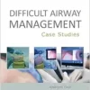 Difficult Airway Management: Case Studies (PDF)