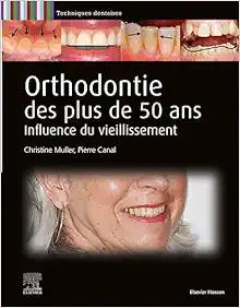 Orthodontie Des Plus De 50 Ans: Influence Du Vieillissement (PDF)