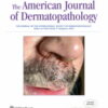 American Journal of Dermatopathology: Volume 45 (1 – 5) 2024 PDF