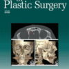 Annals of Plastic Surgery: Volume 92 (1 – 5) 2024 PDF