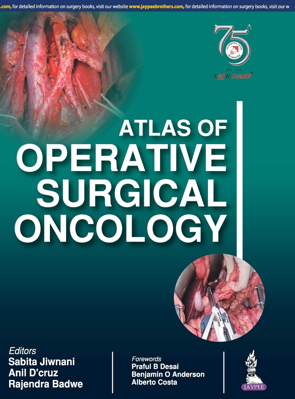 Atlas of Operative Surgical Oncology 1st Edition (PDF)