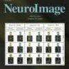 NeuroImage: Volume 246 to Volume 264 2022 PDF