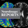 Neuroimage: Reports: Volume 1 (Issue 1 to Issue 4) 2021 PDF