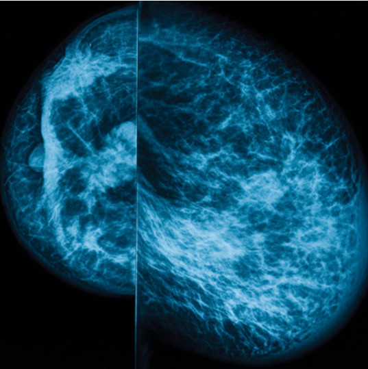 UCSF Breast Imaging Oakstone 2024