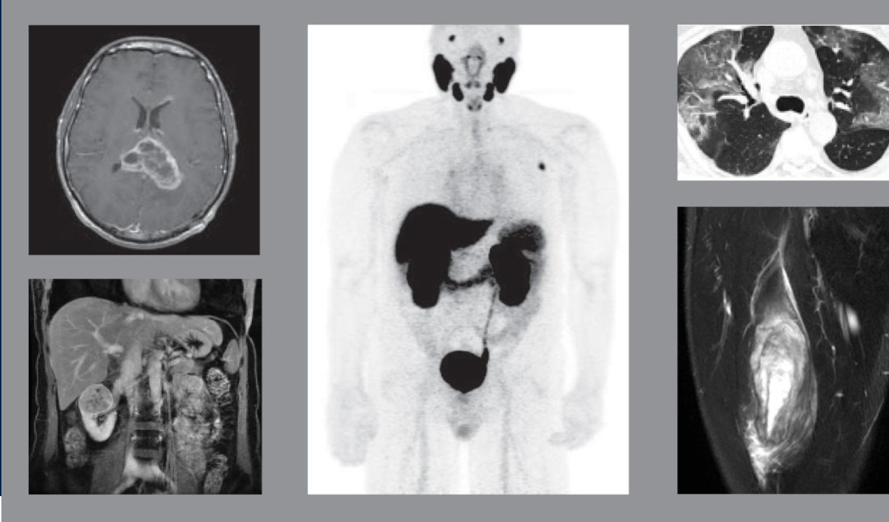 UCSF Radiology Annual Review 2024 (Course)