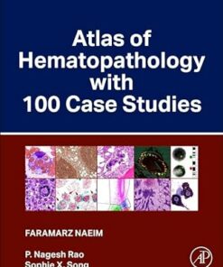 Atlas Of Hematopathology With 100 Case Studies (PDF)
